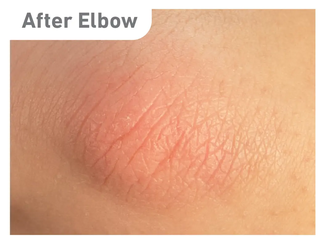 O'Keeffe's Skin Repair Ultimate Relief: Guaranteed Relief for